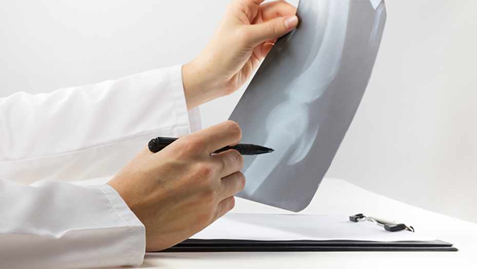 Doctor exams the broken arm in an x-ray.